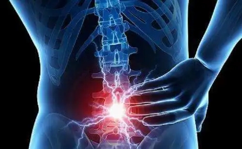 腰椎间盘突出最好的治疗方法 （腰椎间盘突出症的3种常用治疗方法！）