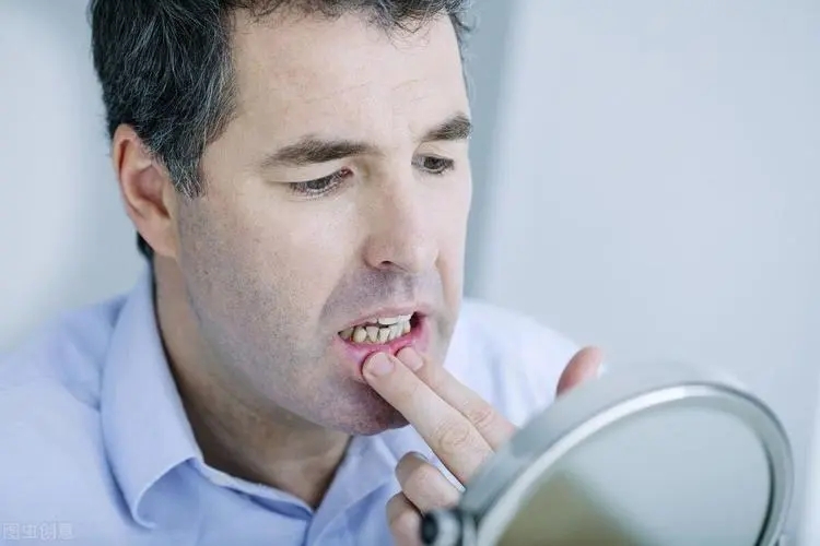牙龈肿痛怎么办？（如何快速缓解疼痛？）